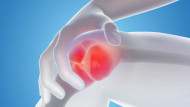 osteoarthritis in the workplace