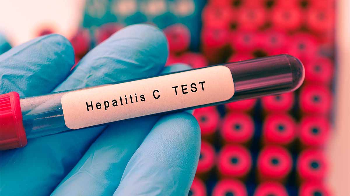 NHS to roll out at-home hepatitis C testing kits
