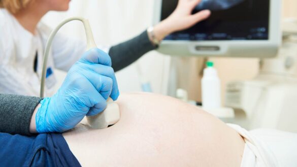 Sonographer conducting an ultrasound scan on a pregnant woman