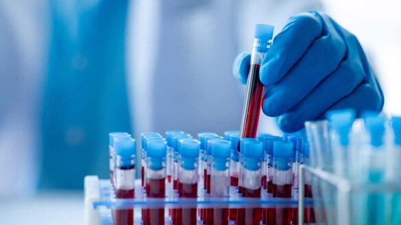 A lab assistant handling test tubes of blood samples
