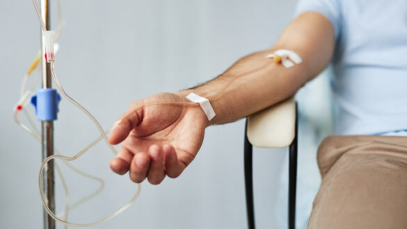 Chemotherapy